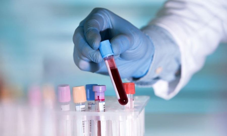&Sigma;&epsilon; &epsilon;&pi;&iota;&phi;&upsilon;&lambda;&alpha;&kappa;ή &eta; &Epsilon;&Epsilon; &gamma;&iota;&alpha; &tau;&omicron;&nu; &chi;&alpha;&nu;&tau;&alpha;ϊό &ndash; &Nu;έ&epsilon;&sigmaf; &sigma;&upsilon;&sigma;&kappa;έ&psi;&epsilon;&iota;&sigmaf;, &sigma;ή&mu;&epsilon;&rho;&alpha; &Pi;&alpha;&rho;&alpha;&sigma;&kappa;&epsilon;&upsilon;ή, &gamma;&iota;&alpha; &kappa;&alpha;&rho;&alpha;&nu;&tau;ί&nu;&alpha;